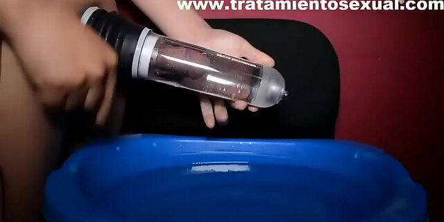 anal
